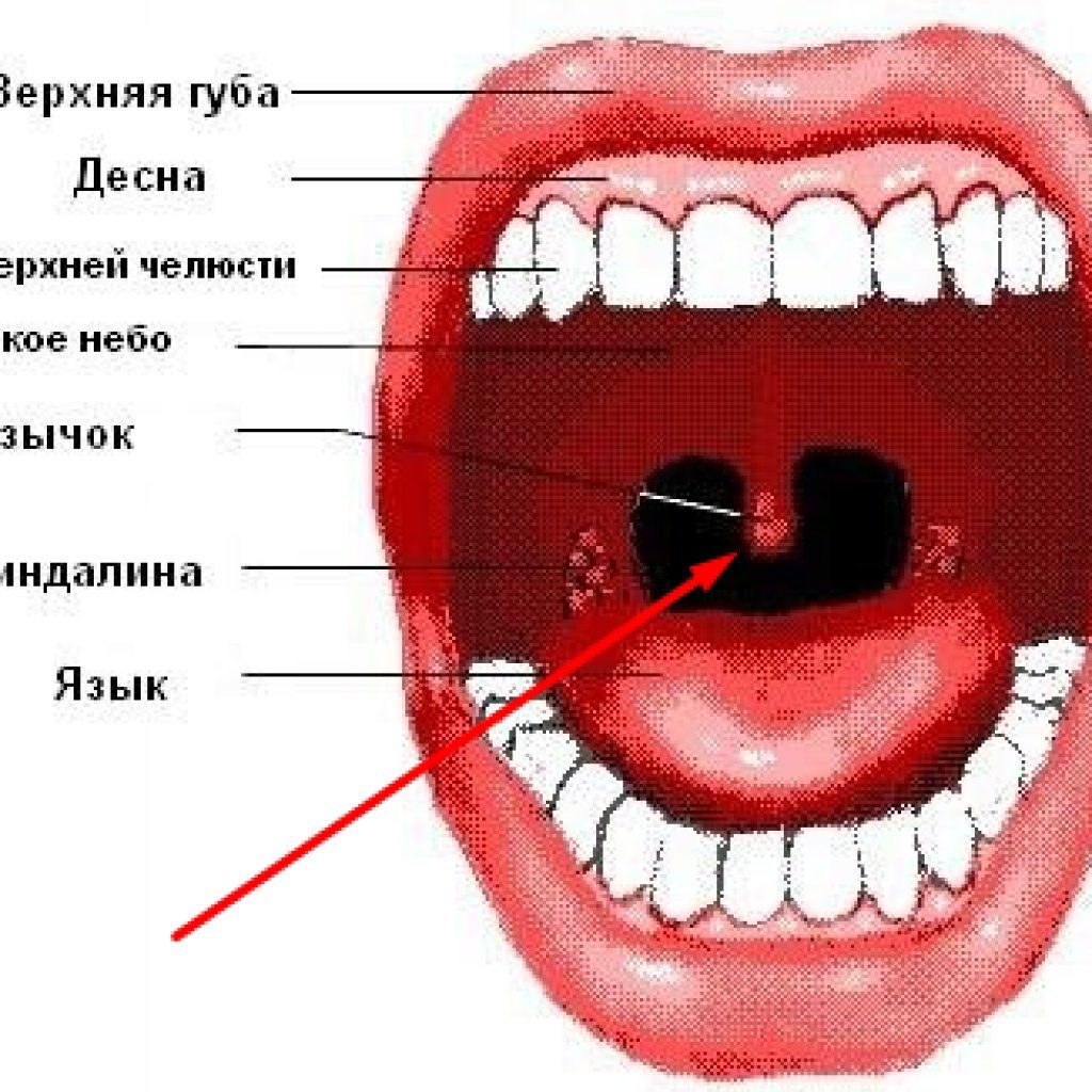 2 маленький язык. Воспаление небного язычка. Маленький язычок в горле