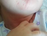 Потничка или цветение?