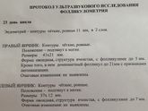 Лютеинизация фолликула