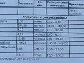 Девочки, прогестерон конкретно завышен.