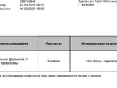 Анальз на определение пола
