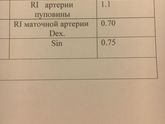 Допплерометрия.