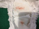 Сегодня ребёнку 3е сутки,