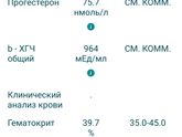 Пришёл хгч.