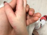 Сделайте репост, пожалуйста🩸🩸🩸 ! Паразиты в организме!