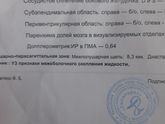 Кто сталкивался о чем