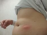 6 день стимуляции, 8