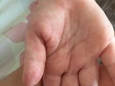 Девочки, у ребёнка одна