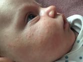 Девочки такая проблема у