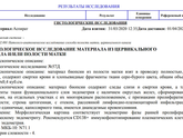 Пришла гистология.