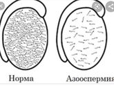 SOS? микро-теse (биопсия) и ЭКО (квота)