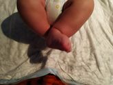 Девочки у кого у деток так было?? Фото в комментах