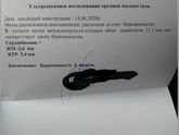 Сегодня прошла первое узи