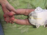 Был приём у ортопеда
