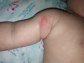Укус