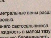 Девочки кому ставили правосторонний