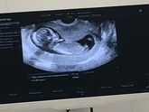 13недель и 6 дней 🥰