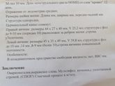 Овариомегалия что это?