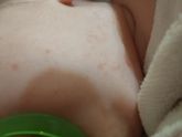 Малышку сыпет то на