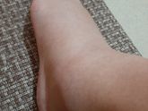 Мои ножки, отекаю ужасно