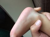 Что это может быть? Хелп(( наш врач не знает