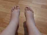 Мои ножки, отекаю ужасно