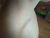 Что за фигня у ребенка на шее?