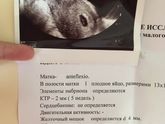 Сходила на узи ?