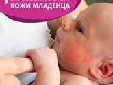 5 особенностей кожи младенца