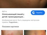 Водянистые пятна на коже