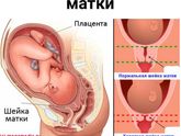 Короткая шейка. 33 неделя беременности.