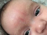 Подскажите что это за шелушения на бровках ?