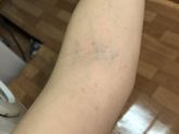 🆘 что так проявляется?