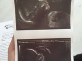 Фотографии на 21 неделе беременности