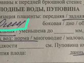 Девочки, расшифруйте пожалуйста