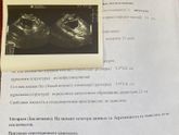 Беременность не исключается
