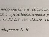 УЗИ головки новорождённого