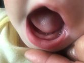 Зубы 🦷