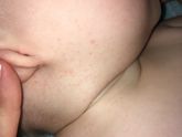 Потничка? Аллергия?