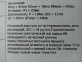 Девочки, кто в Экг