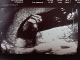 Наш 2 скрининг🥰 09.12.2020