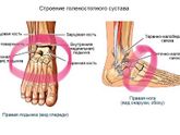 Очень болит подъем на ноге ?