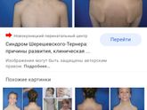 Двойной контур головы и шеи плода