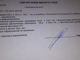 Овуляция?