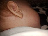 Сыпь помогите разобраться