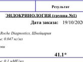 Девочки у кого был повышен пролактин сюдааааа