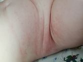 Аллергия?