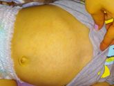 Непонятные прыщики