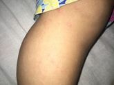 У кого так было?Скажите