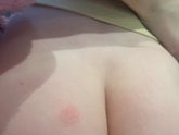 Пятно на попе!